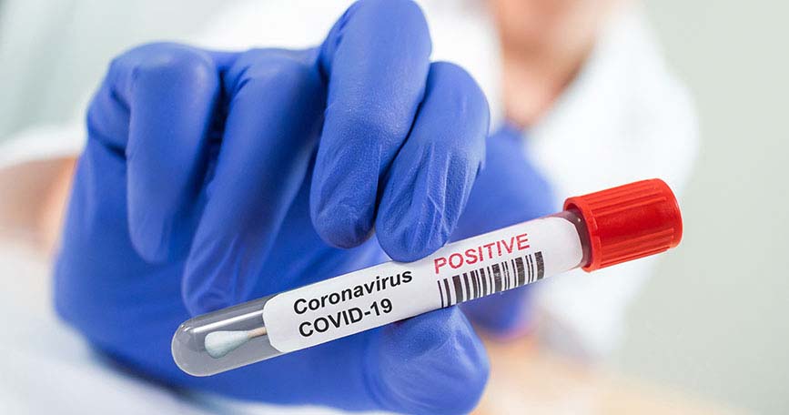 Coronavirus viernes: 11 casos en VGG, 2 en Alvear y 1 en Pueblo Esther