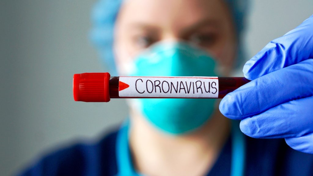 Coronavirus sábado: 37 casos positivos en VGG, en tanto Alvear y Pueblo Esther no reportaron casos positivos