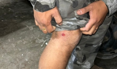 Operativo en Alvear: un policía herido y un detenido tras un violento allanamiento